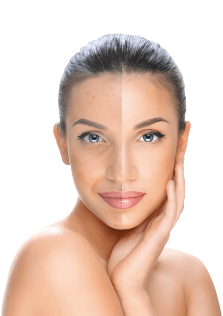 piperina-woman-1.png piperina-woman-1.png